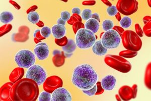 Leucemia – Câncer de Sangue
