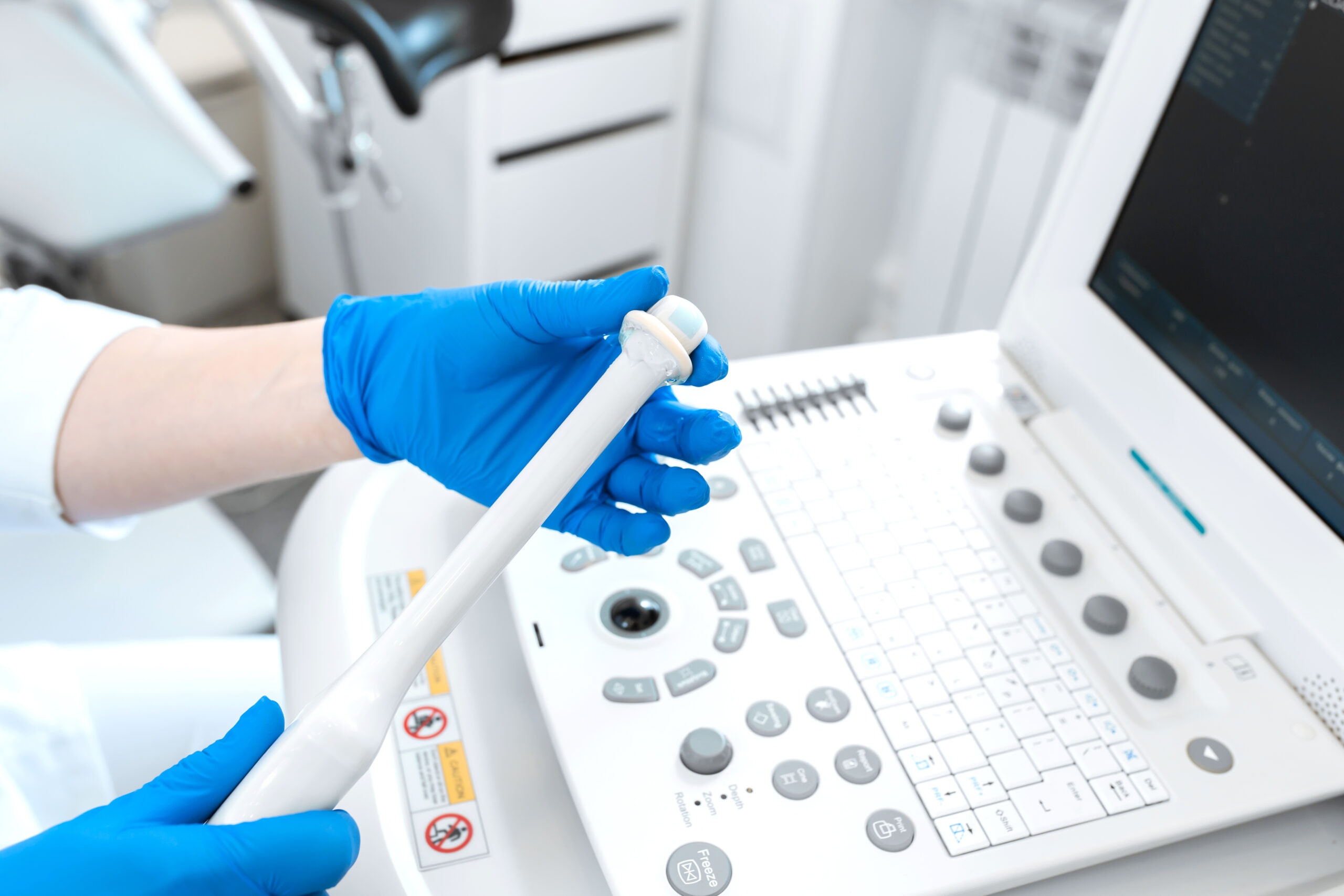 APARELHO DE ULTRASSONOGRAFIA APARELHO DE ULTRASSONOGRAFIA