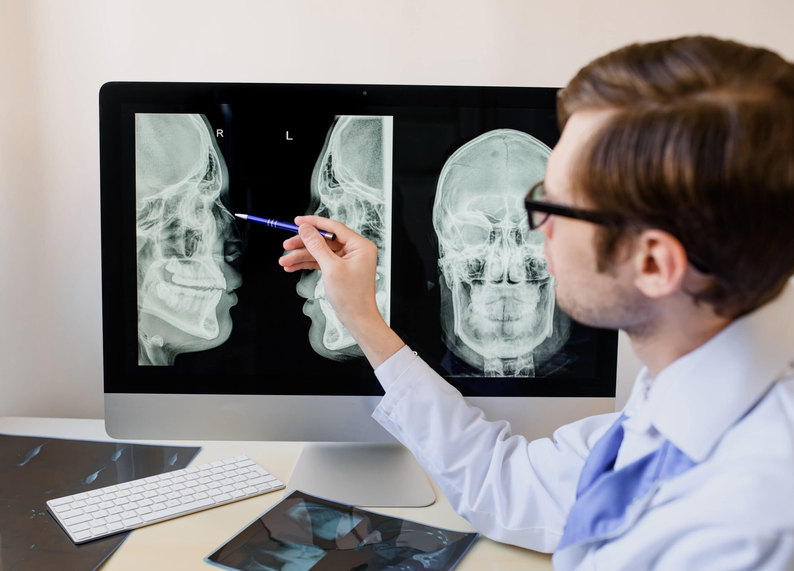 Médico analisando resultado de raio-xdo seio da face Médico analisando resultado de raio-xdo seio da face