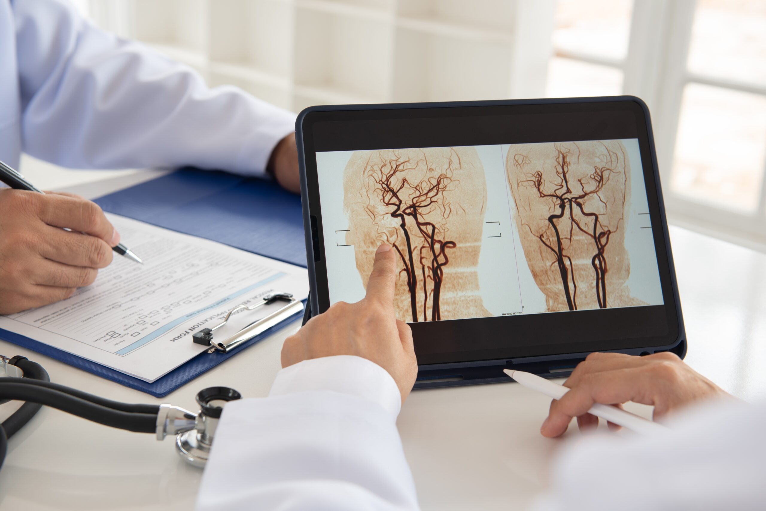 “Médico aponta para imagem de ressonância magnética cerebral exibida em tablet. “Médico aponta para imagem de ressonância magnética cerebral exibida em tablet.