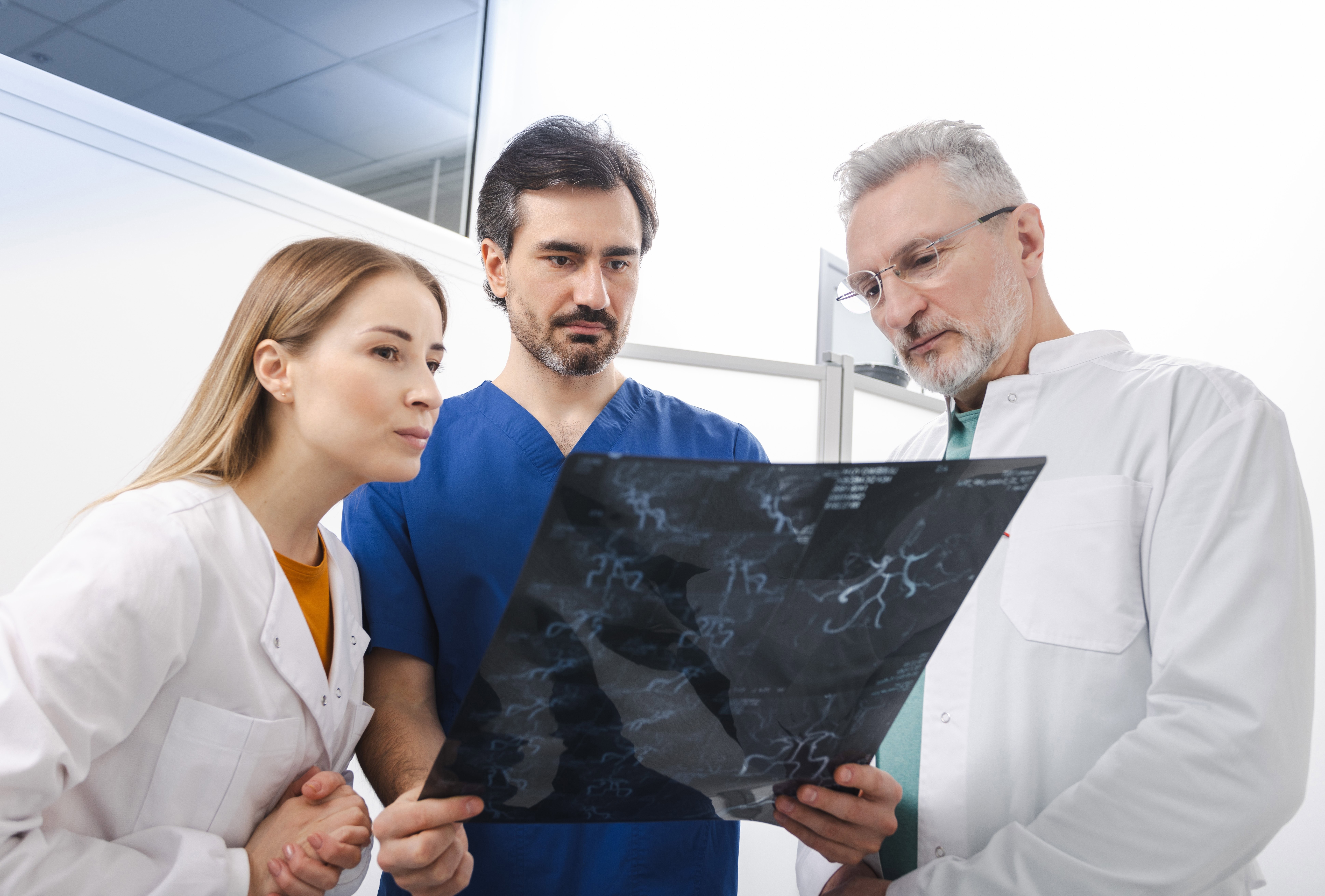 Três profissionais da saúde observam atentamente uma chapa de exame neurológico, analisando imagens de vasos cerebrais. Três profissionais da saúde observam atentamente uma chapa de exame neurológico, analisando imagens de vasos cerebrais.