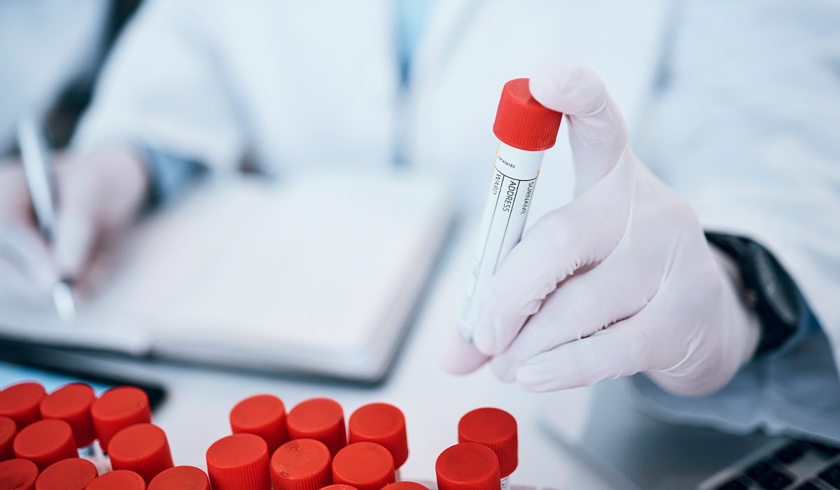 Tubo de exame de sangue