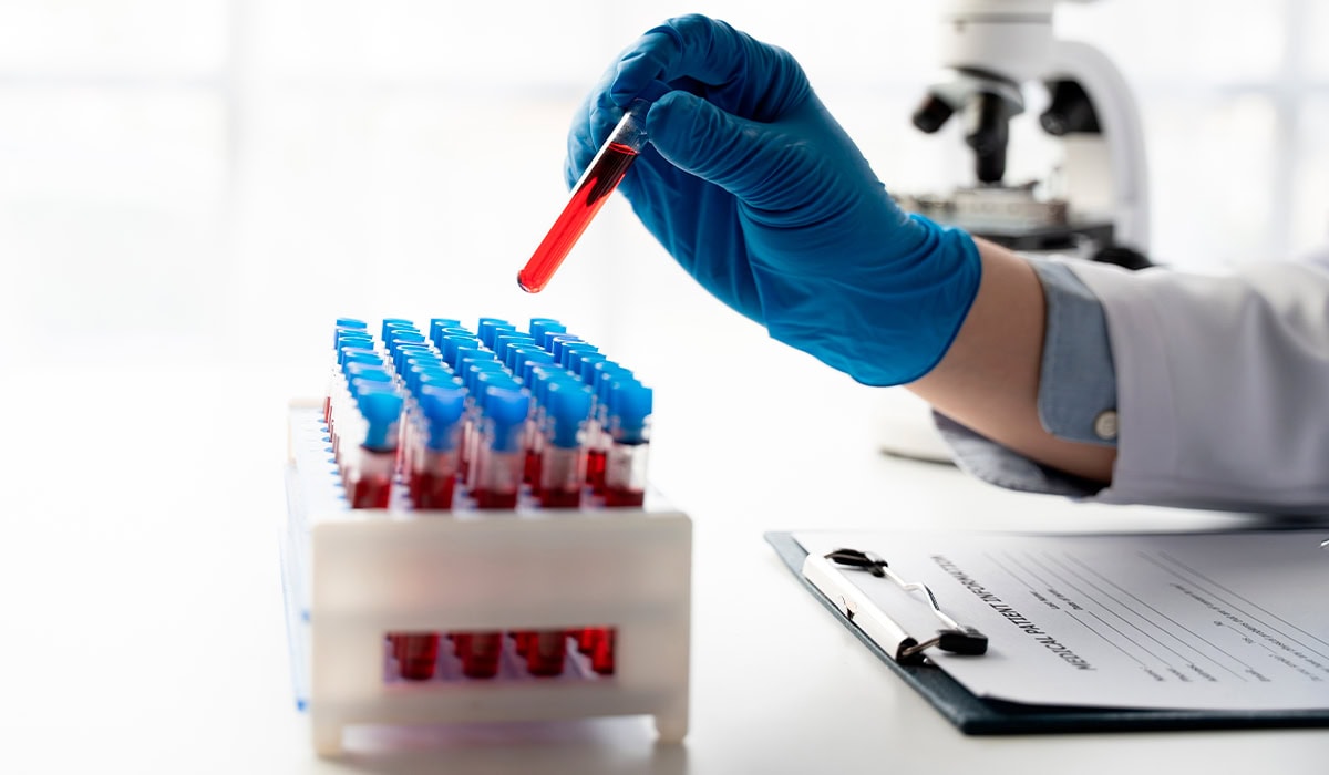 Tubo de coleta de sangue sendo preparados para análise