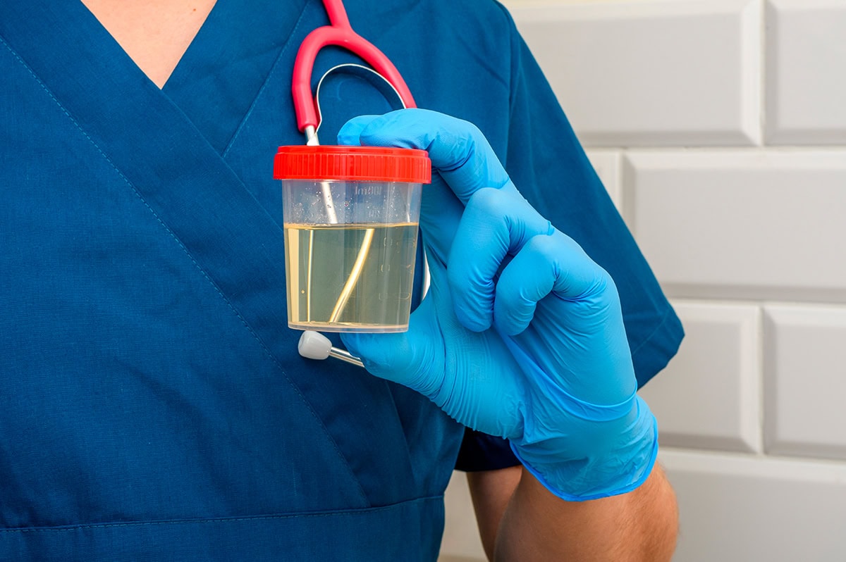 Profissional de análises clínicas com amostra de urina para exame de Urocultura