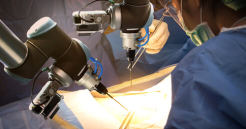 imagem de uma cirurgia robótica realizada com profissionais acompanhando de perto cada procedimento