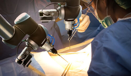 imagem de uma cirurgia robótica realizada com profissionais acompanhando de perto cada procedimento