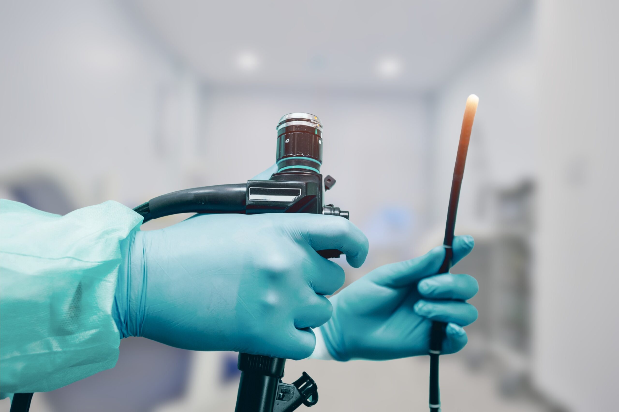 Endoscopia com Biópsia e Teste de Urease