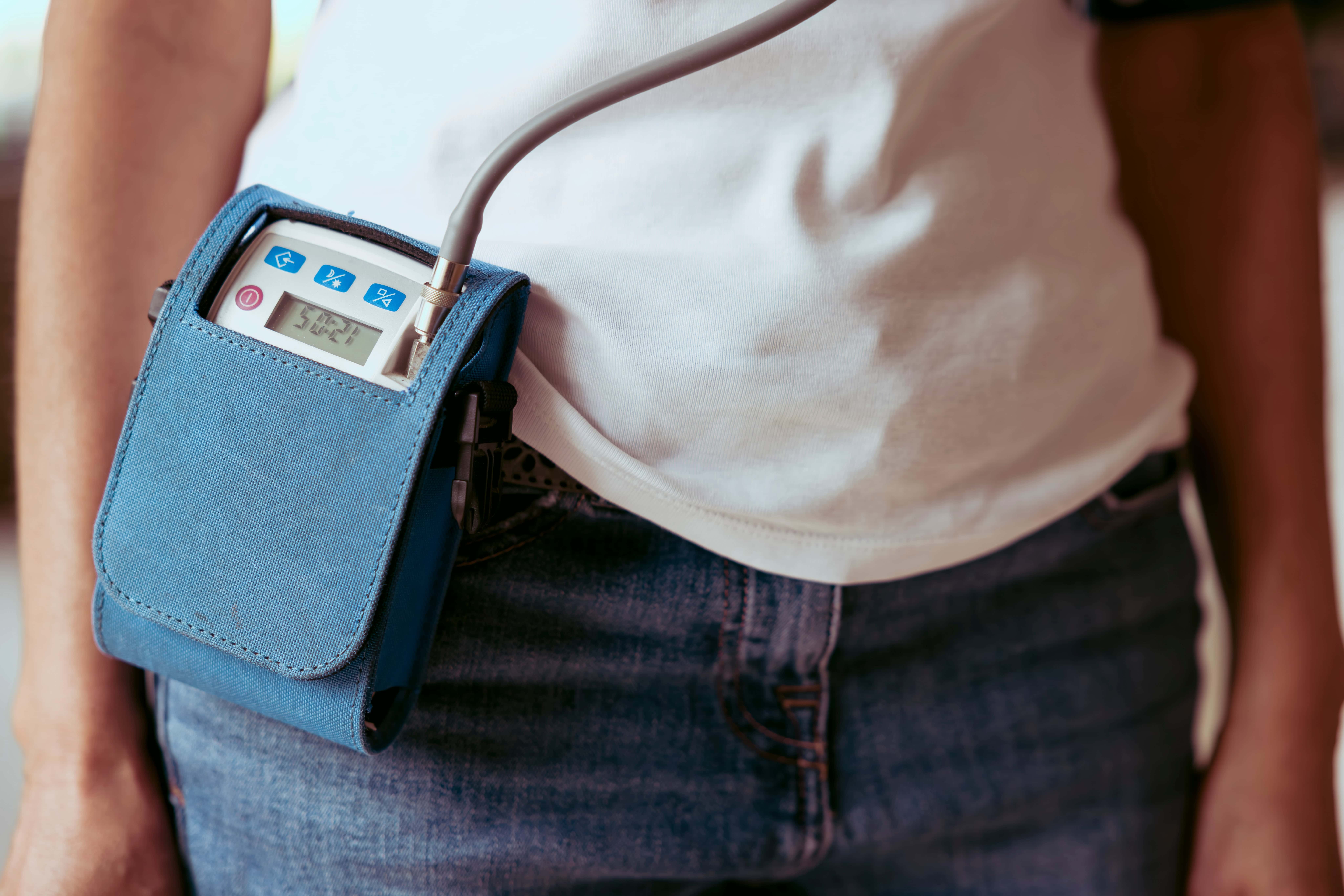 aparelho de Monitorização Ambulatorial da Pressão Arterial (MAPA)