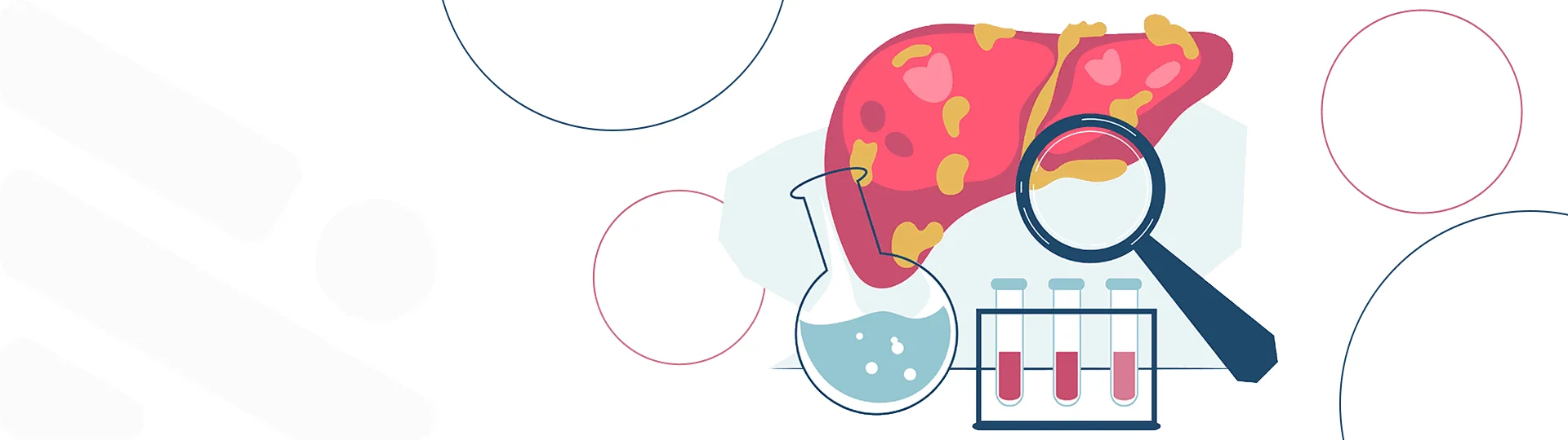 RICHET-Banner-blog-gordura-figado-1920x540px