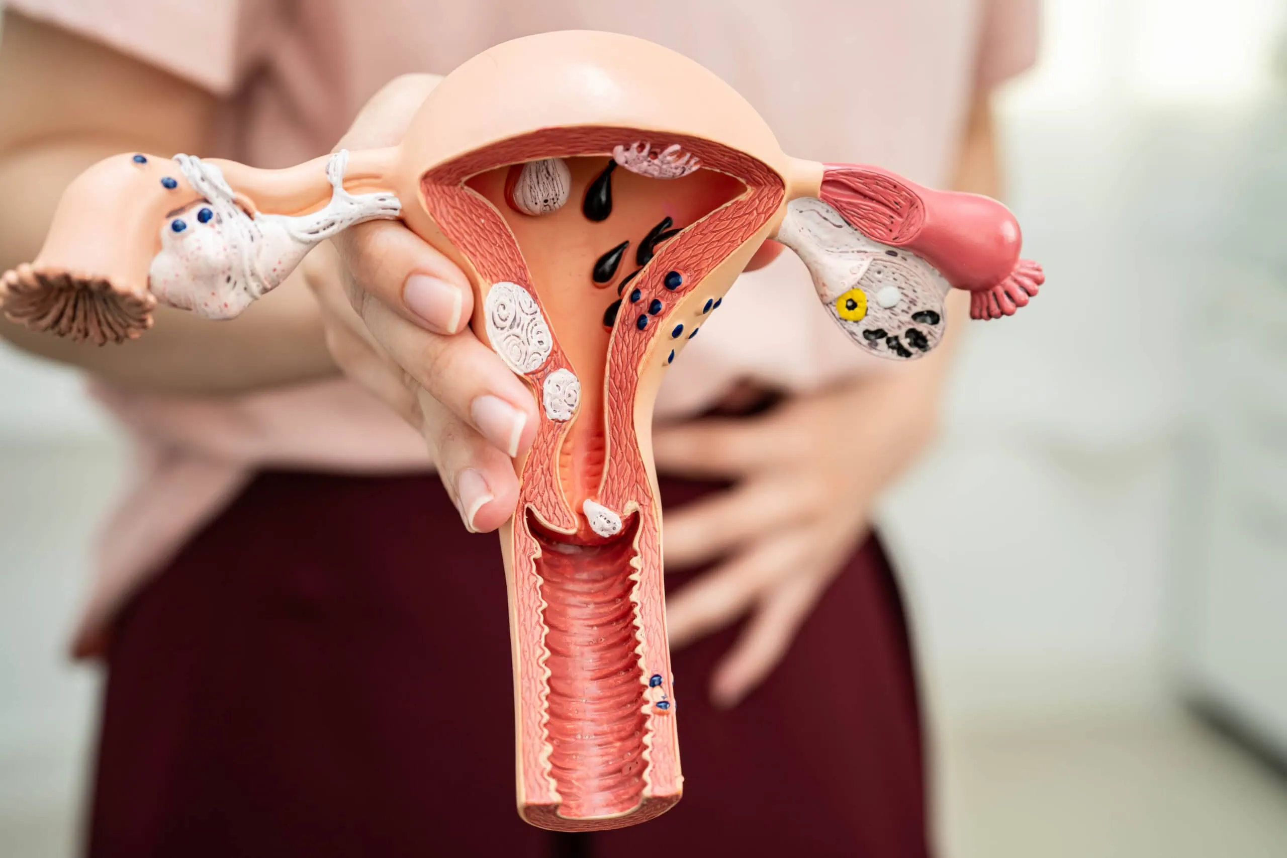 Uterus, Asian, woman holding human anatomy model.