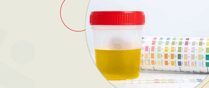 Exame de Urina: O que ele pode revelar sobre sua saúde