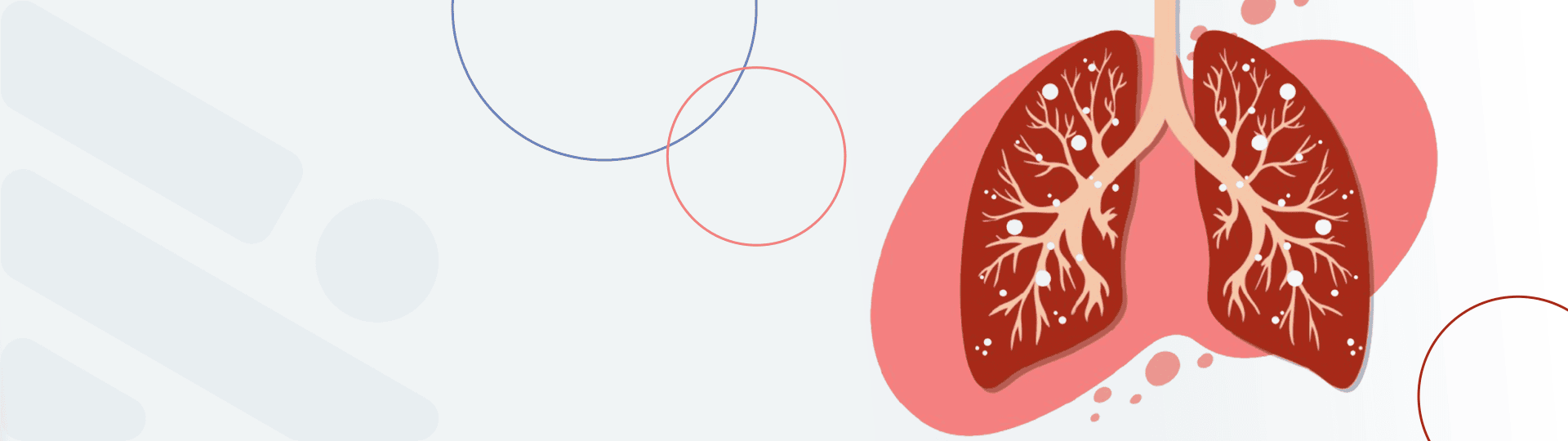 RICHET-Blog-Hipertensão-Arterial-Pulmonar