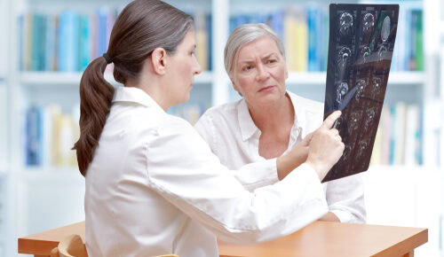 Tipos de AVC: conheça os sintomas e saiba o que fazer