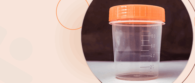 Exame de Fezes: Entenda como ele ajuda na prevenção de doenças