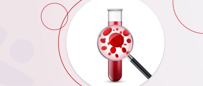 Ferritina Alta: O que significa e por que merece atenção