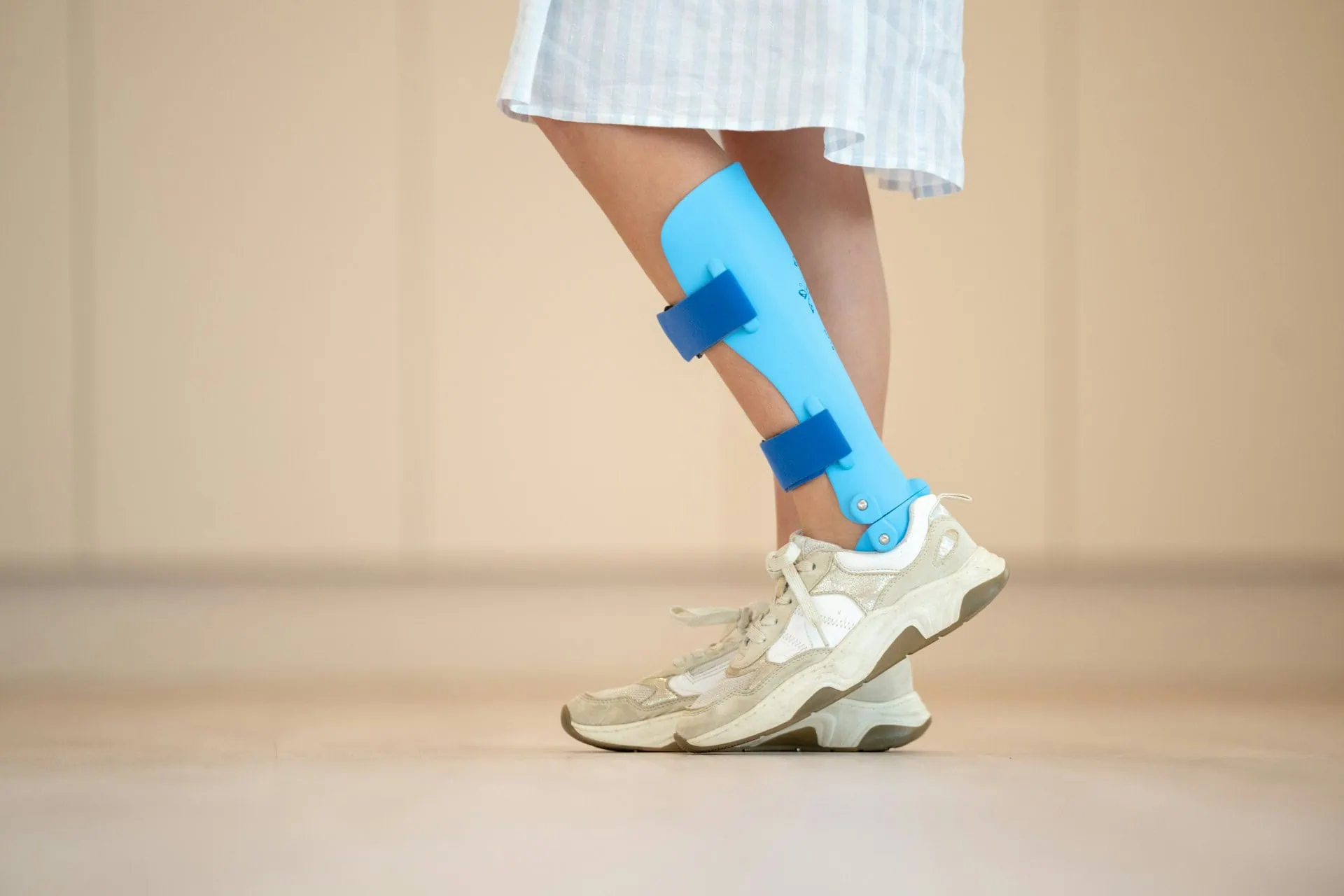 A imagem mostra as pernas de uma pessoa caminhando com tênis de corrida branco e com uma órtese (dispositivo externo protetor) na perna, na região da panturrilha e do tornozelo.