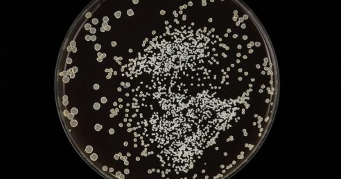 Imagem de uma lâmina de microscópio.