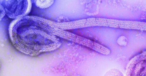 Imagem microscópica do vírus Ebola, com tratamento estético de imagem nas cores roxas e lilás.