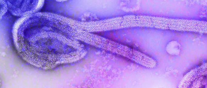 Imagem microscópica do vírus Ebola, com tratamento estético de imagem nas cores roxas e lilás.