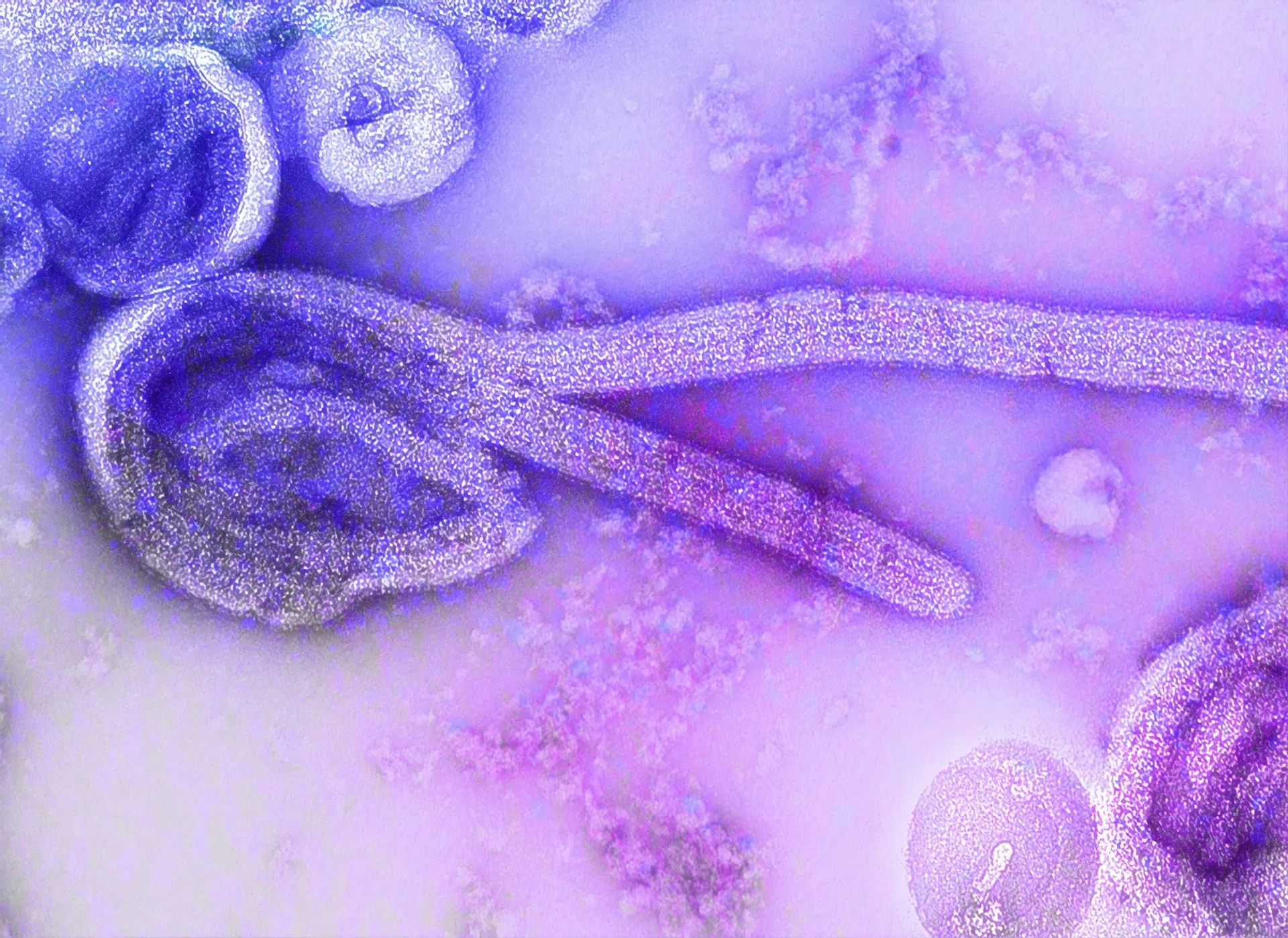Imagem microscópica do vírus Ebola, com tratamento estético de imagem nas cores roxas e lilás.