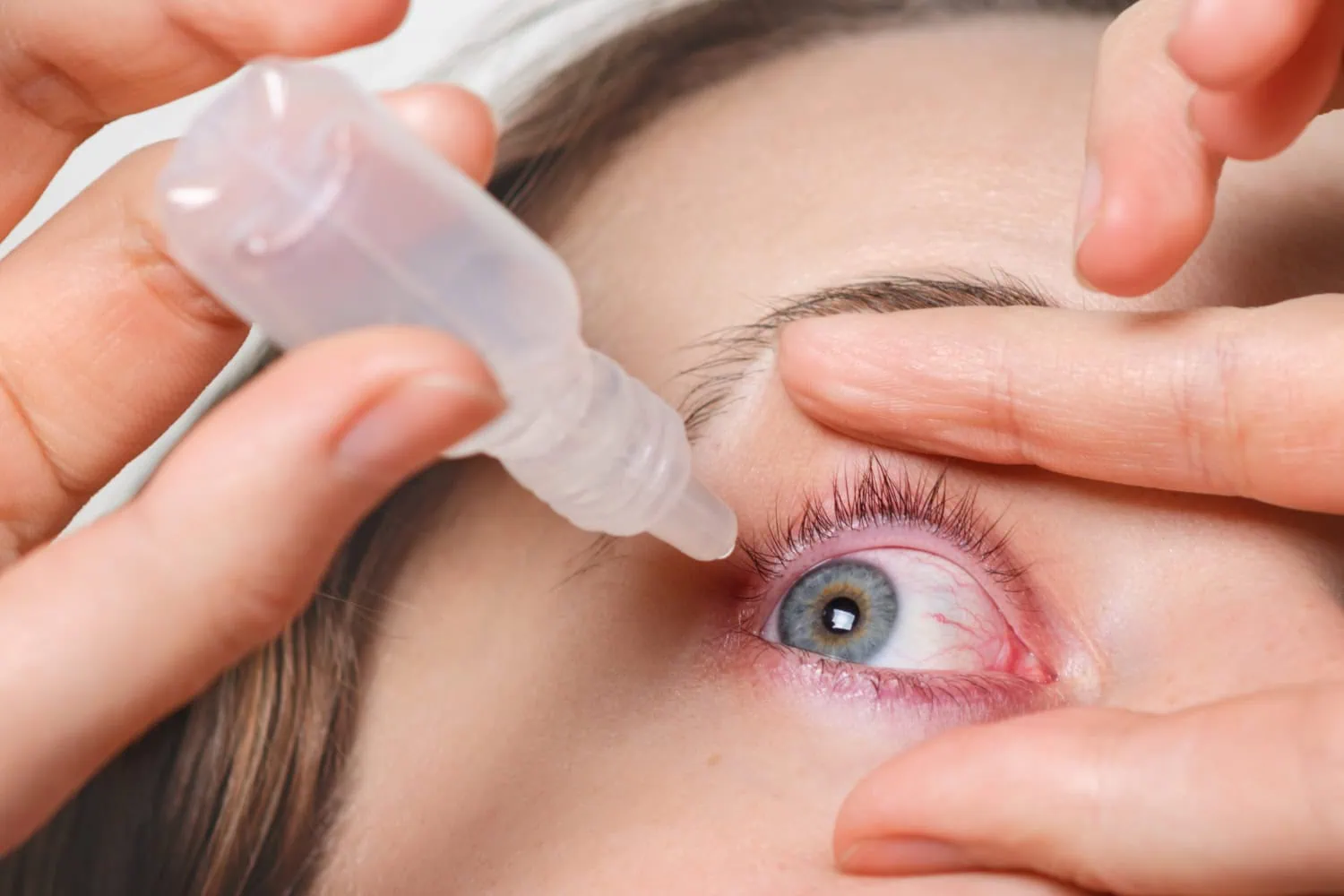 Pessoa fazendo uso de colírio para os olhos.