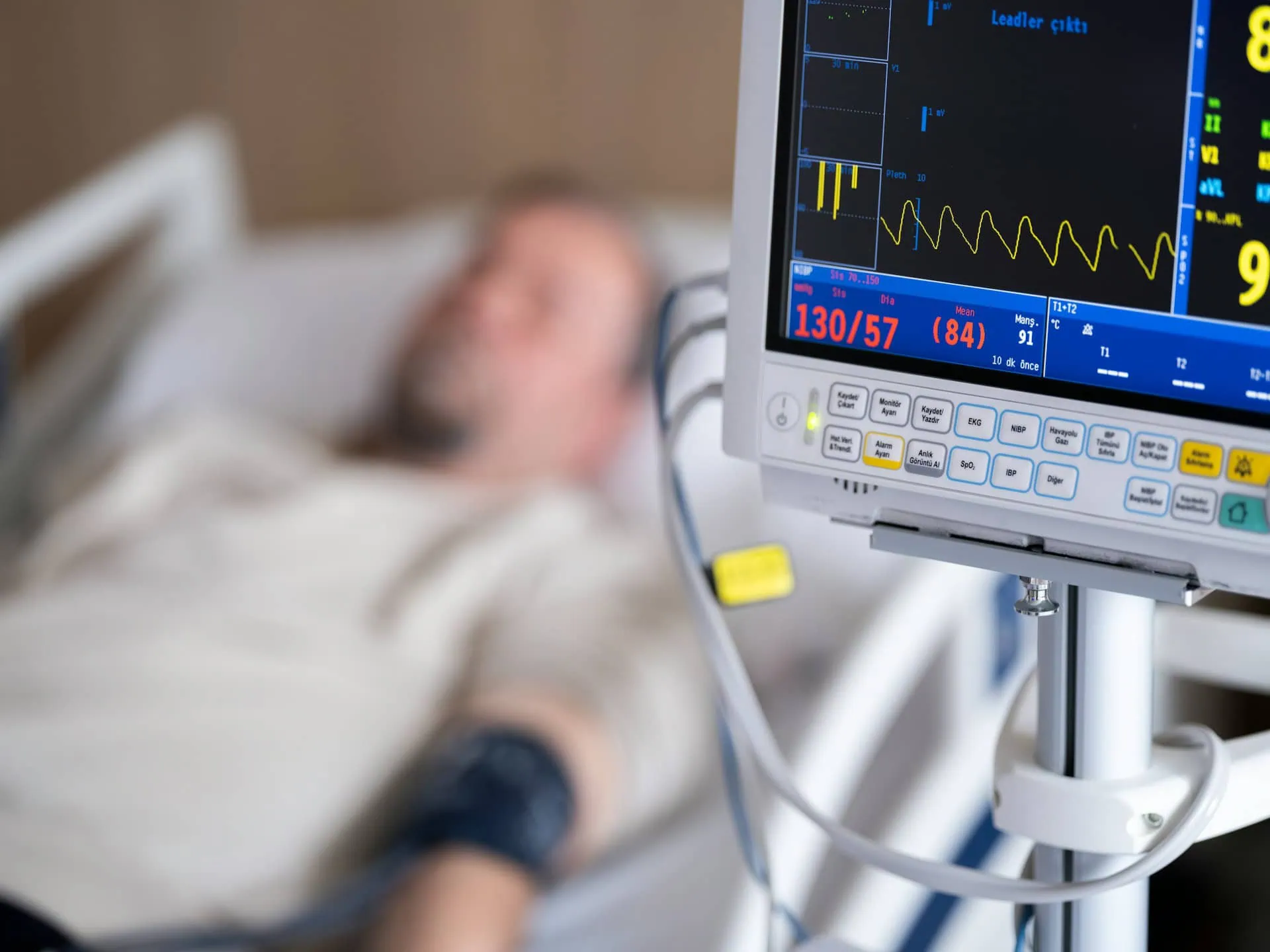 Imagem mostrar um homem deitado em uma cama de hospital ao lado de um monitor cardíaco.