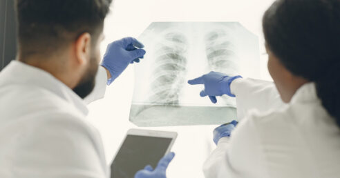 Médicos avaliando uma radiografia do pulmão.