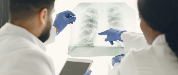 Médicos avaliando uma radiografia do pulmão.
