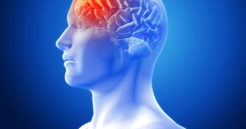 ALT: imagem representando o corpo humano, focando na parte cerebral, onde indica uma lesão.